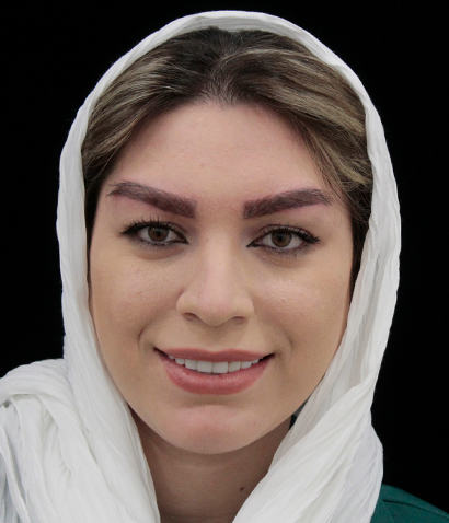 بعد از کاشت ابرو