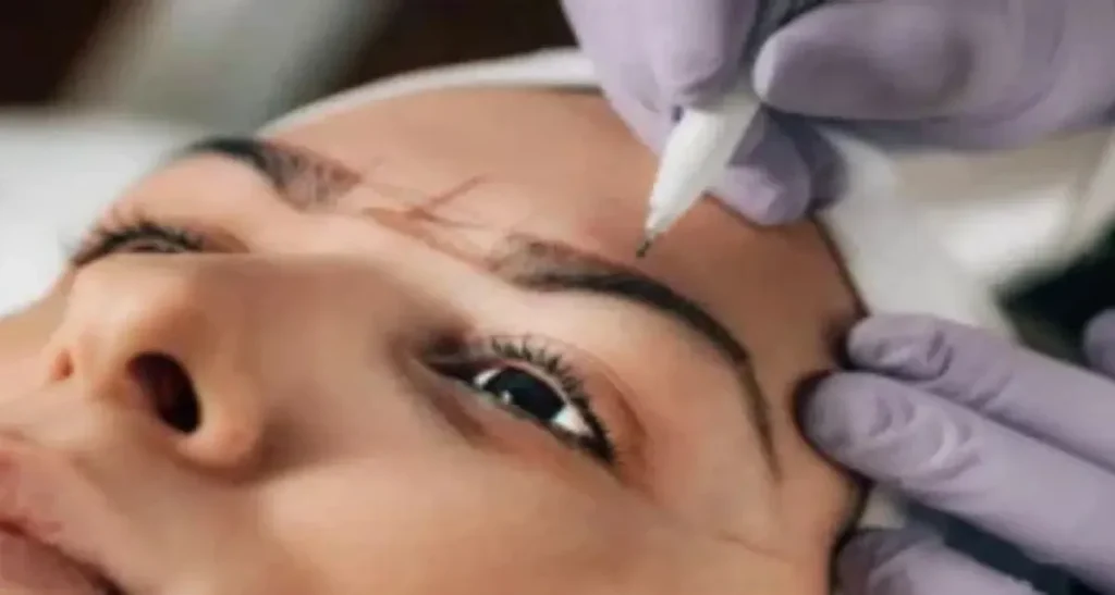 ارتباط بین کاشت ابرو و ریزش مو