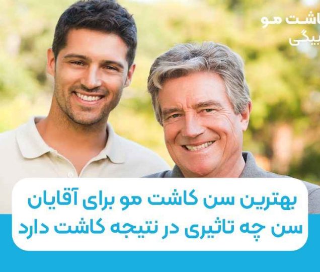 بهترین سن کاشت مو برای آقایان: سن چه تاثیری در نتیجه کاشت دارد