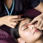 کاشت ابرو در افرادی که سابقه جراحی پلاستیک دارند