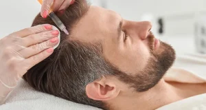 کاشت مو با ایدز امکان پذیر است؟