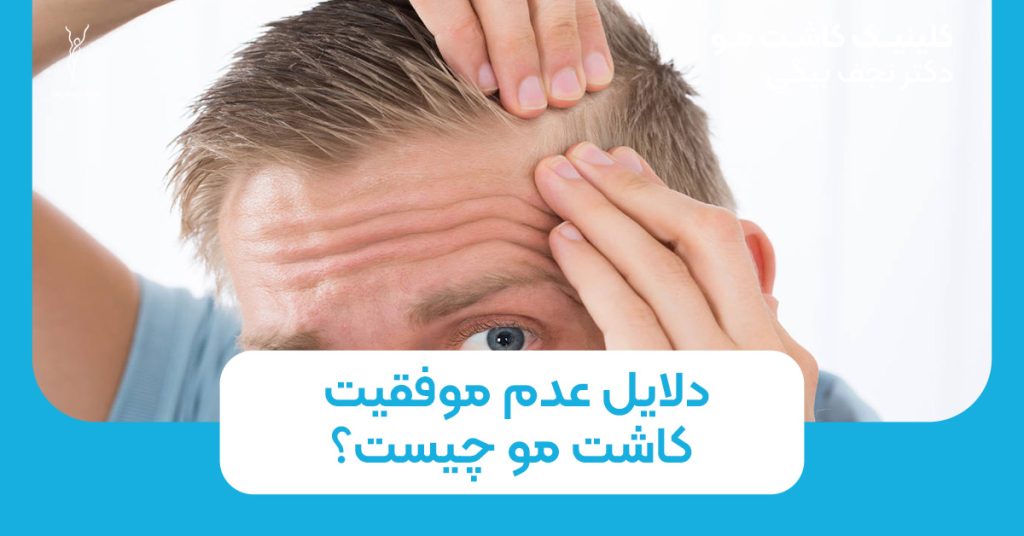 دلایل عدم موفقیت کاشت مو چیست؟