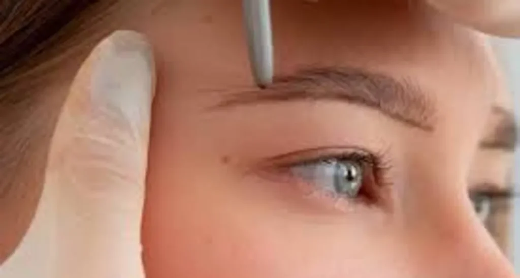 برای کاشت ابرو از کجا مو برداشته می شود