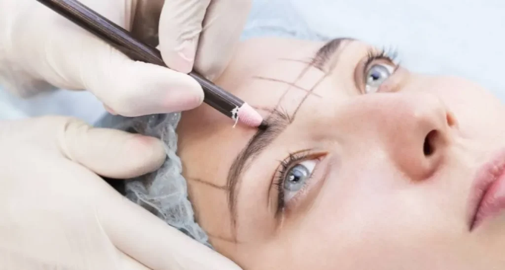 برداشت مو از پشت سر برای کاشت ابرو