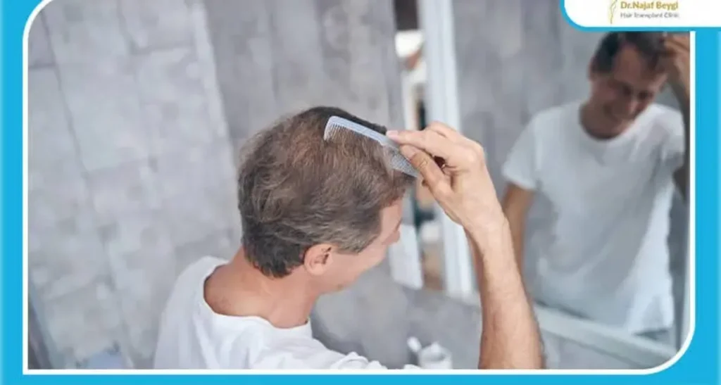 بهترین مرکز کاشت مو با تراکم بالا