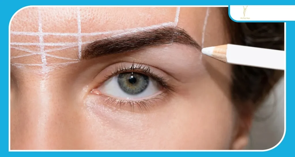 چه عواملی باعث عدم موفقیت کاشت مو می شود