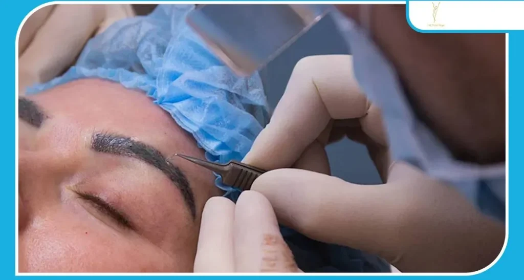 کاشت ابرو روی تاتو