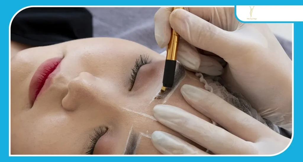 دلایل اصلی عدم موفقیت کاشت ابرو