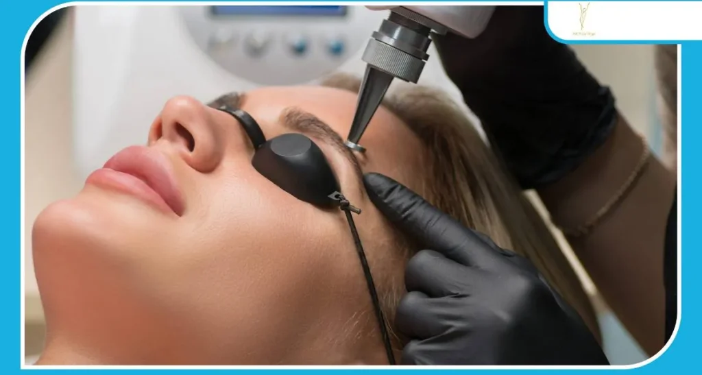 روش های پاک سازی تتو قبل از کاشت ابرو