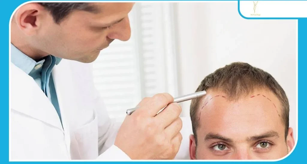 ریسک های احتمالی کاشت مو افراد دیابتی و راهکارهای پیشگیری