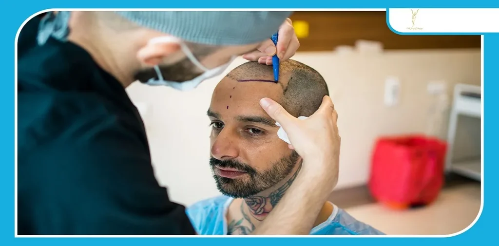 ریسک ها و پیچیدگی های گذاشتن کلاه بعد از کاشت مو