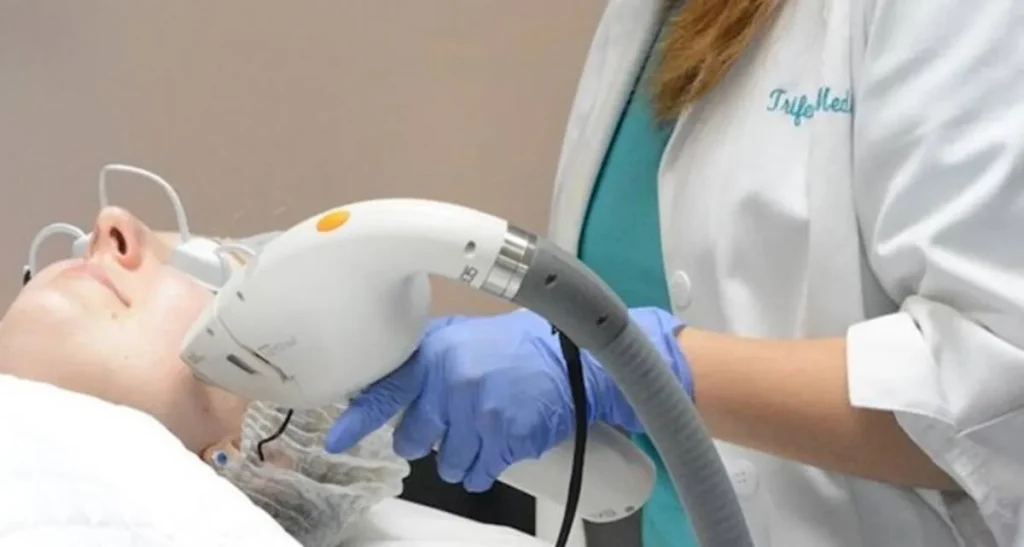 لیزر موهای زائد برای موهای روشن