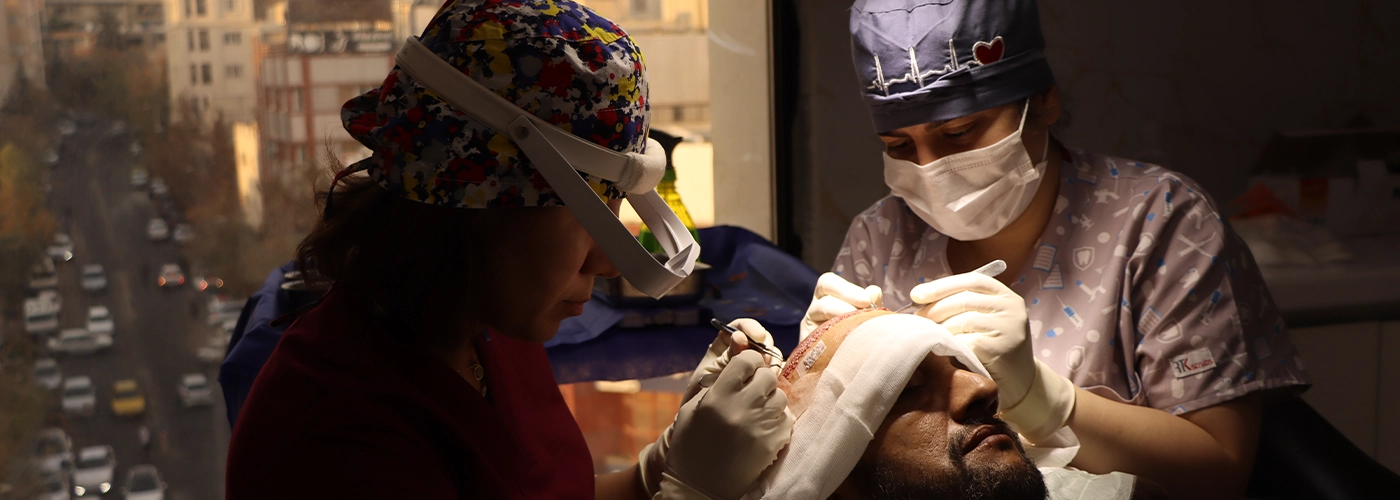 کاشت مو به روش نئوگرافت