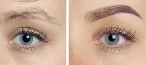 سن مناسب کاشت ابرو