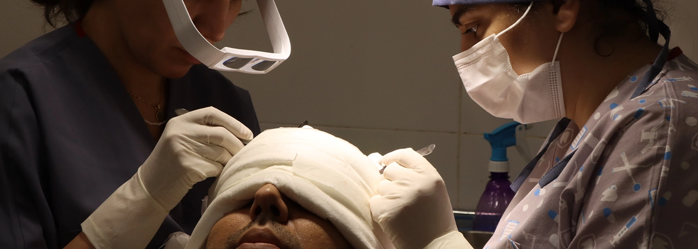 کاشت مو به روش میکروگرافت