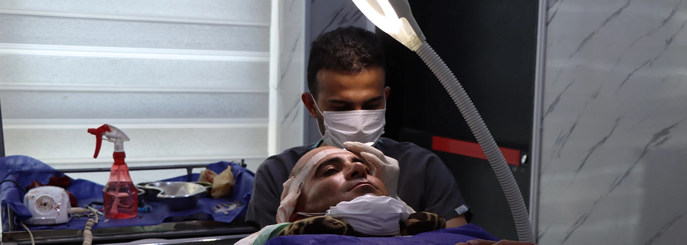 کاشت مو به روش میکروفیت