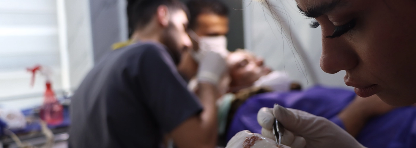 کاشت مو Super FUE