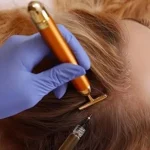 اگزوزوم مو چیست؟