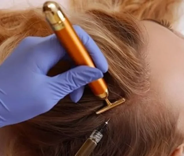 اگزوزوم مو چیست؟