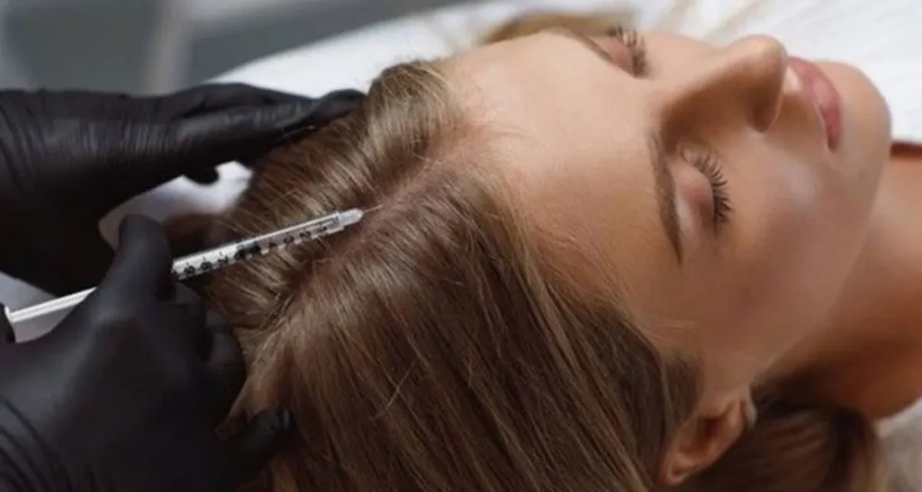 اگزوزوم تراپی مو چیست