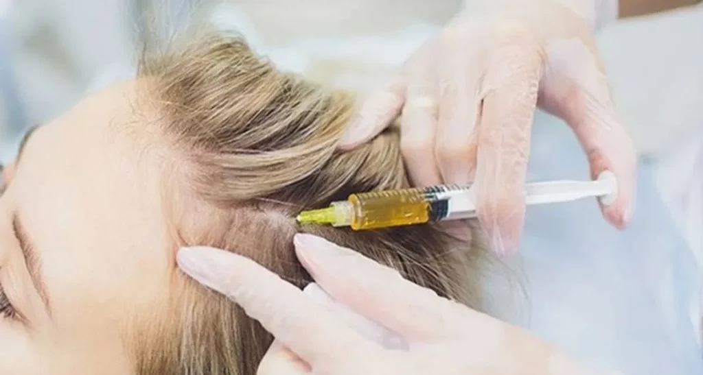 اگزوزوم مو برای درمان ریزش