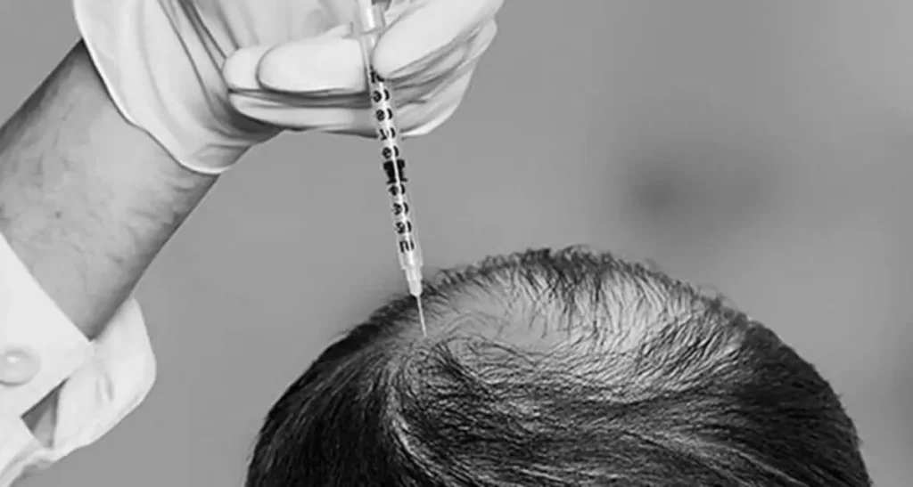 اگزوزوم مو در سعادت آباد