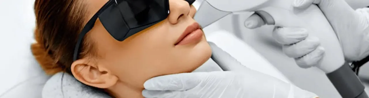 لیزر موهای زائد چانه: از بین بردن موهای زائد به روشی قطعی