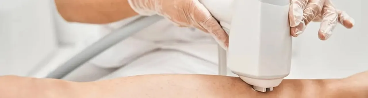 لیزر موهای زائد زیر بغل: روش قطعی برای رفع موهای زائد