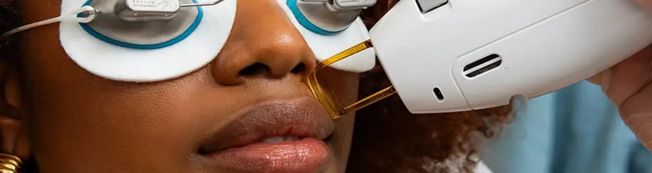 لیزر موهای زائد پشت لب: روشی بیدرد و موثر برای رفع موهای اضافی