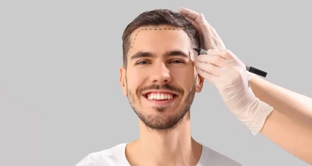 شرایط کاشت مو در تهران برای آقایان