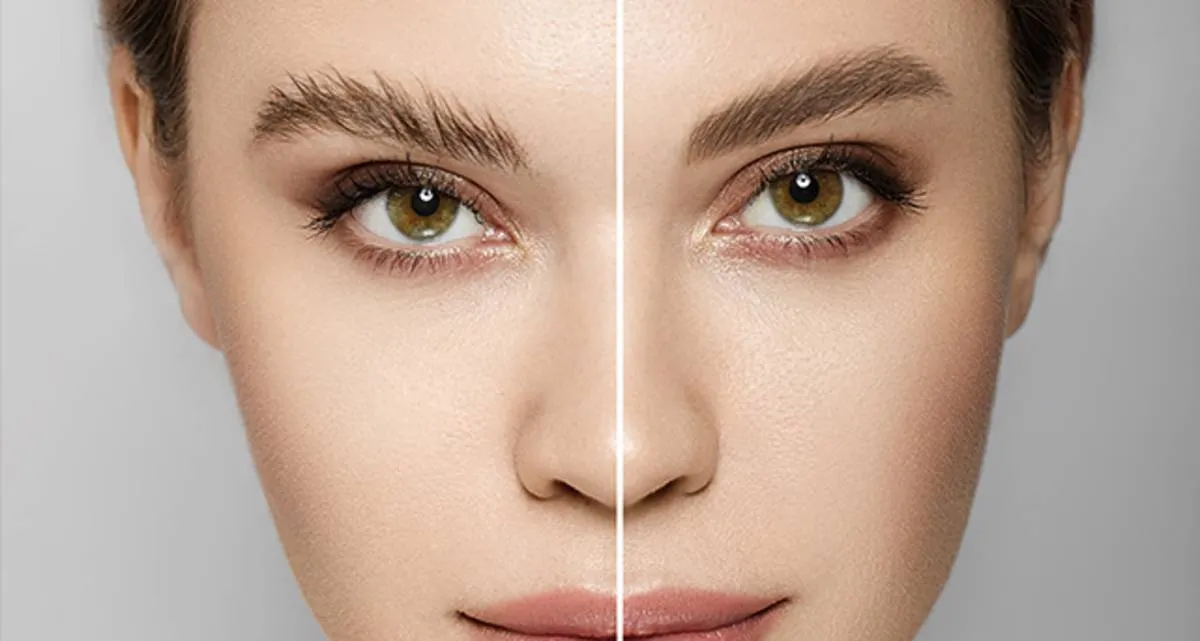 نواحی اصلی برداشت مو برای کاشت ابرو کجاست؟