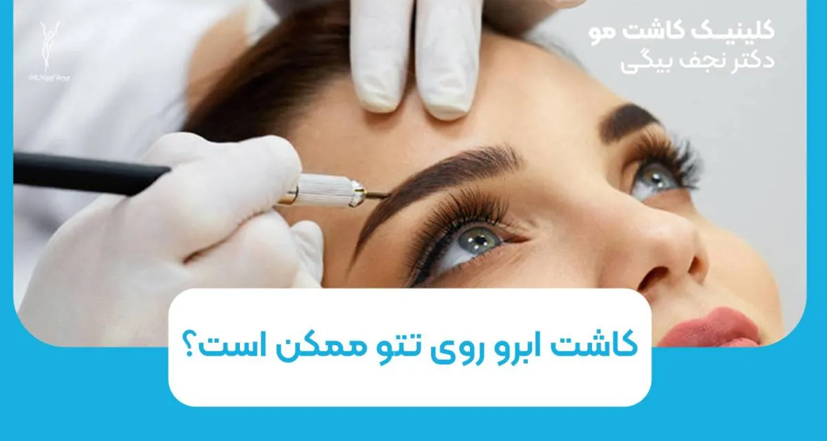 کاشت ابرو روی تتو ممکن است ؟