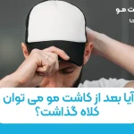 آیا بعد از کاشت مو می توان کلاه گذاشت؟