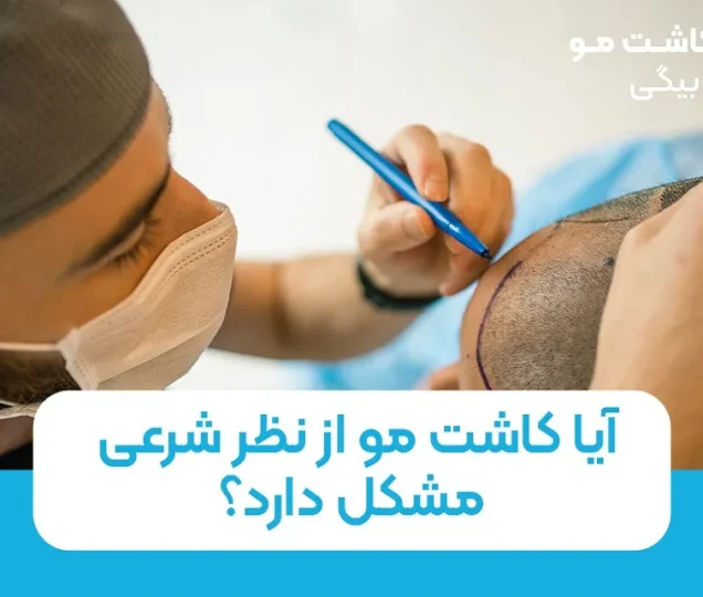 آیا کاشت مو از نظر شرعی مشکل دارد؟