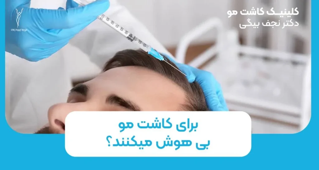 برای کاشت مو بیهوش میکنند؟