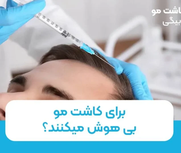 برای کاشت مو بیهوش میکنند؟