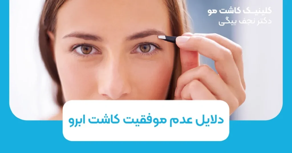 دلایل عدم موفقیت کاشت ابرو