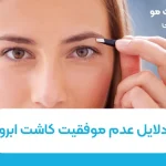 دلایل عدم موفقیت کاشت ابرو