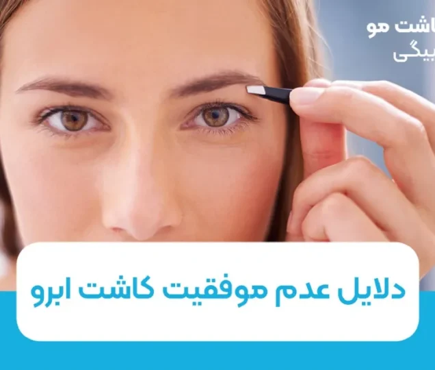 دلایل عدم موفقیت کاشت ابرو