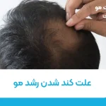 علت کند شدن رشد مو
