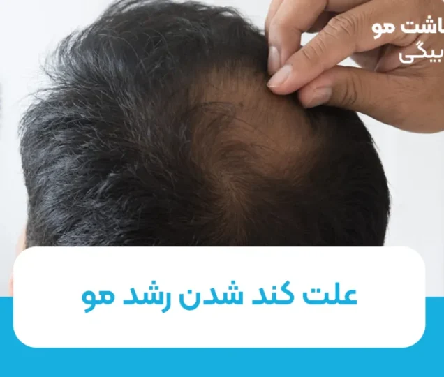 علت کند شدن رشد مو