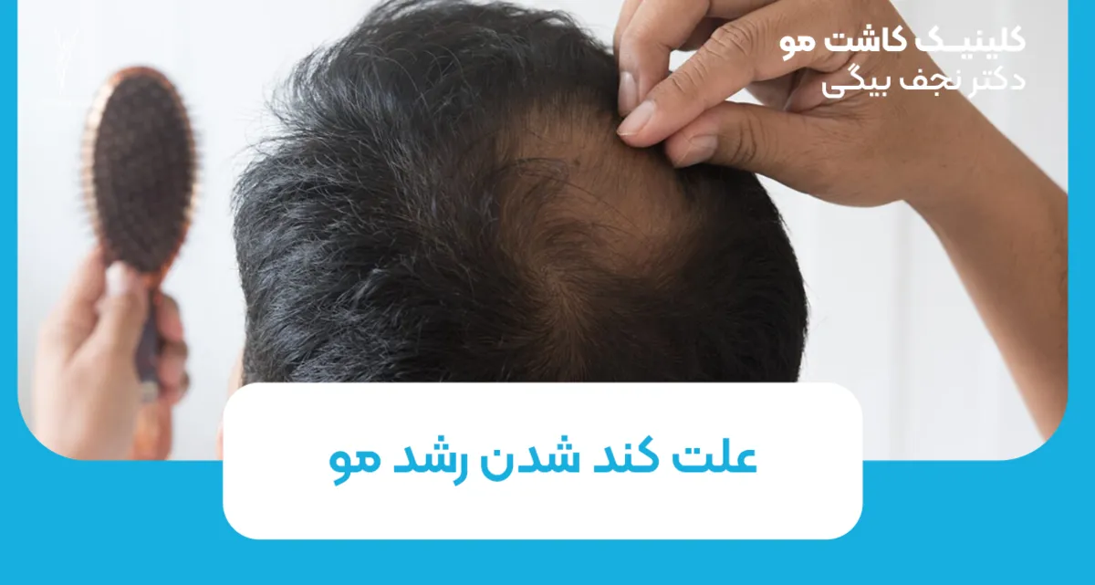 علت کند شدن رشد مو