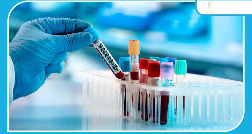 آزمایش های مهم قبل از کاشت ابرو