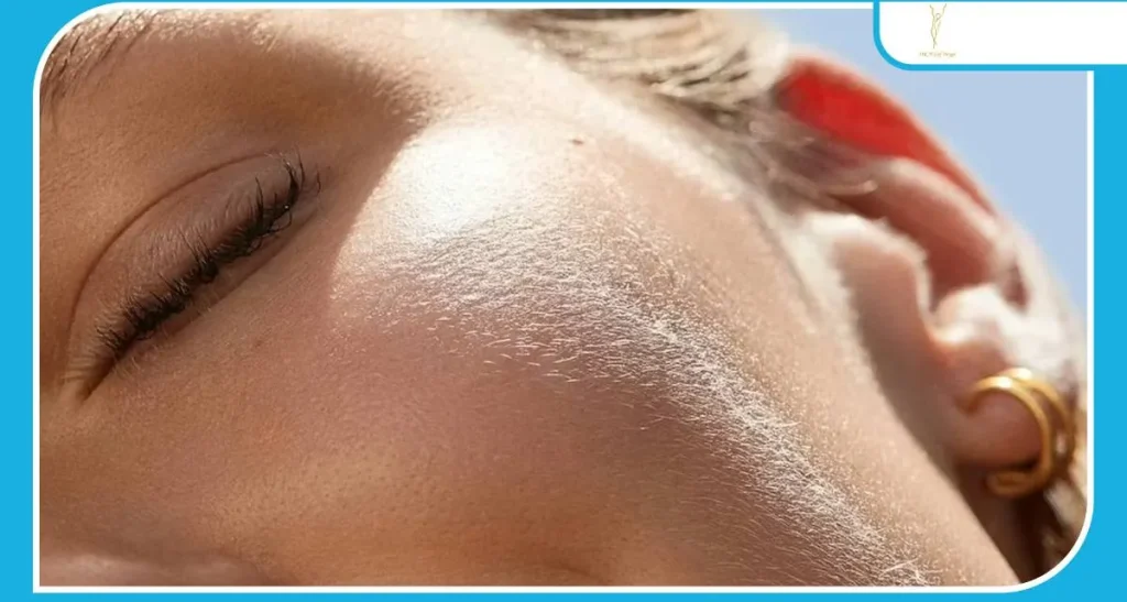 آیا لیزر موهای پرزی ممکن است؟