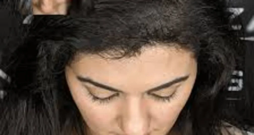 اسکالپ مو چیست