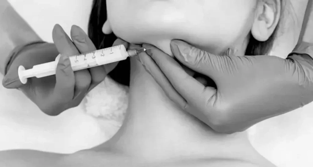 تزریق مزوتراپی غبغب