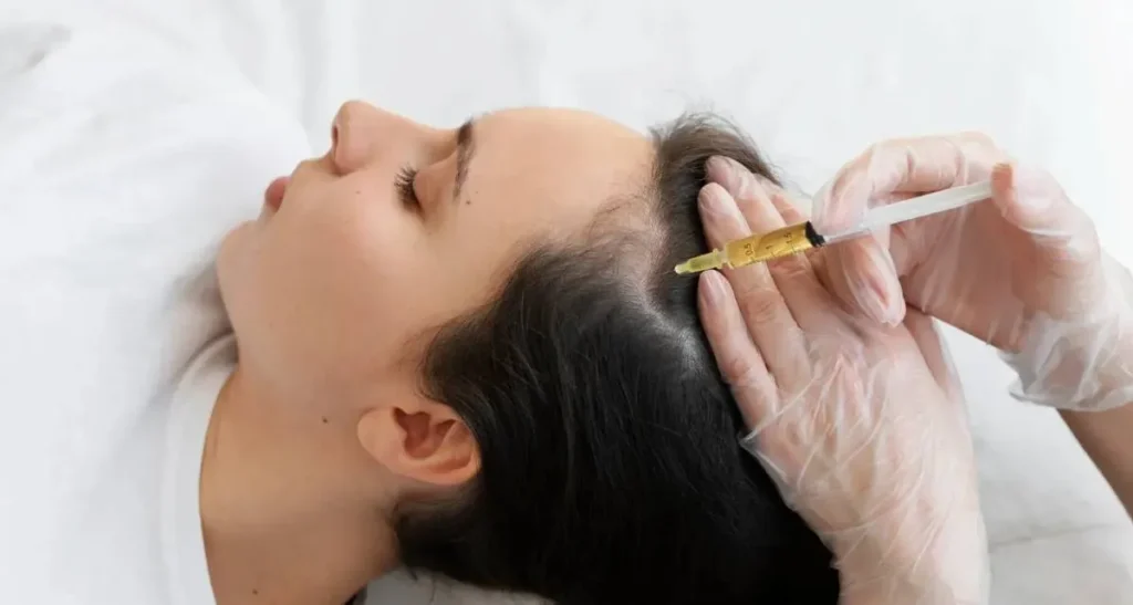 تفاوت مزوتراپی و پی آر پی مو