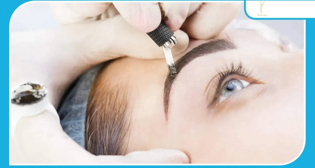 کاشت ابرو برای چه کسانی مناسب است