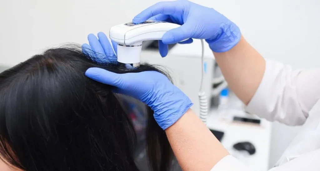 سن کاشت مو برای رسیدن به بهترین نتیجه در زنان