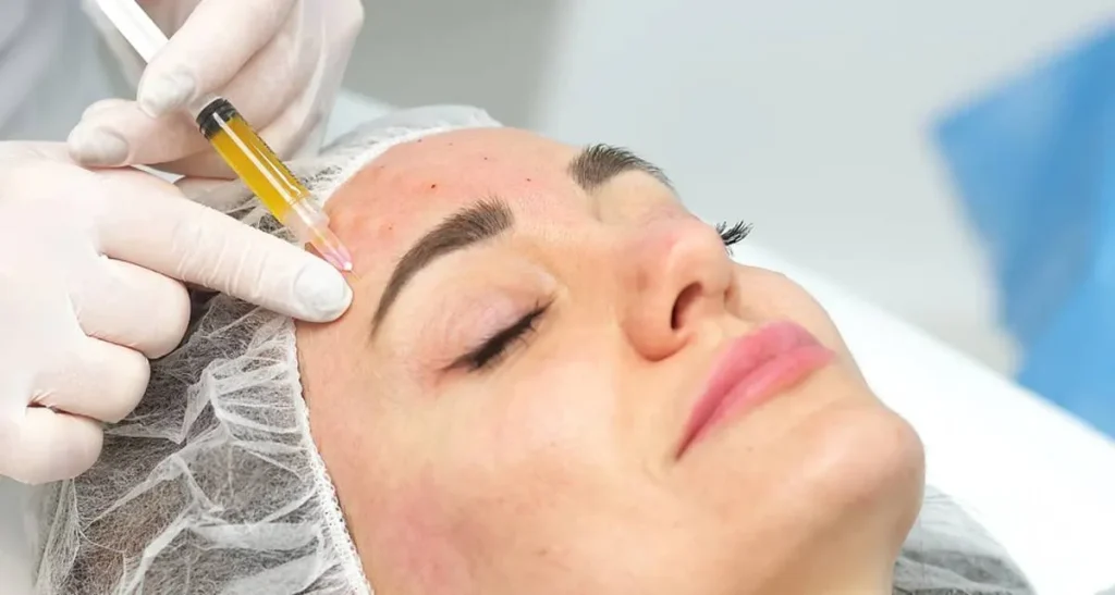 ماندگاری پی آر پی روی صورت چقدر است؟